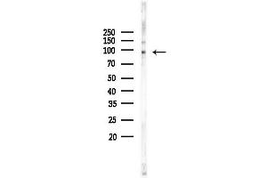Western blot analysis of lysates from COLO205 cells, using PCAF Antibody at 1/1000 dilution.