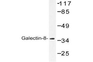 Western blot (WB) analysis of Galectin-8 antibody in extracts from 3T3 cells. (LGALS8 Antikörper)