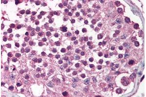 Human Testis (formalin-fixed, paraffin-embedded) stained with MADD antibody ABIN214509 at 2.