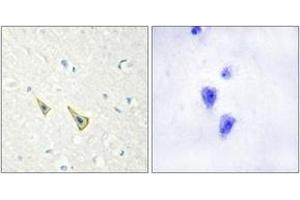 Immunohistochemistry (IHC) image for anti-Kv Channel Interacting Protein 3, Calsenilin (KCNIP3) (AA 29-78), (pSer63) antibody (ABIN1531643)