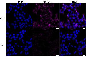Immunocytochemical staining of HeLa cells using ARFGAP3 antibody (ABIN7797533), 1:1,000), Top panel: wild-type (WT), Bottom panal: ARFGAP3 shRNA knockdown (KD). (ARFGAP3 Antikörper)