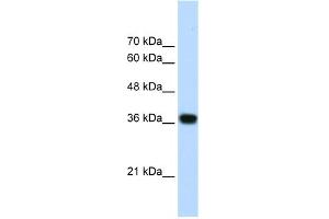 WB Suggested Anti-PSIP1 Antibody Titration:  1. (PSIP1 Antikörper  (N-Term))