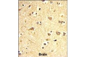 Formalin-fixed and paraffin-embedded human brain reacted with SOX4 Antibody (Center), which was peroxidase-conjugated to the secondary antibody, followed by DAB staining. (SOX4 Antikörper  (AA 269-297))