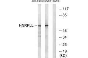 Western Blotting (WB) image for anti-Heterogeneous Nuclear Ribonucleoprotein L-Like (HNRPLL) (AA 241-290) antibody (ABIN2890375) (HNRPLL Antikörper  (AA 241-290))