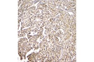 IHC analysis of EVA1A using anti-EVA1A antibody (ABIN6719564). (TMEM166 Antikörper)