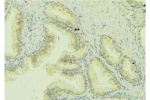 ABIN6279822 at 1/100 staining Mouse colon tissue by IHC-P. (CCL13 Antikörper)