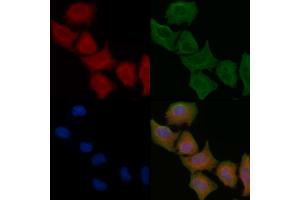 ABIN6261519 and ABIN6266943 staining Hela cells by IF/ICC.