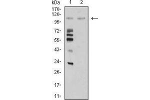 Western Blotting (WB) image for anti-Mindbomb E3 Ubiquitin Protein Ligase 1 (MIB1) (AA 6-221) antibody (ABIN5542433)