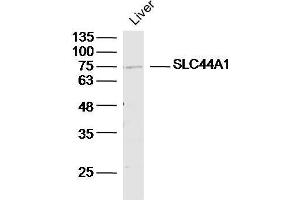 Mouse liver lysates probed with SLC44A1/CD92 Polyclonal Antibody, unconjugated  at 1:300 overnight at 4°C followed by a conjugated secondary antibody for 60 minutes at 37°C. (SLC44A1 Antikörper  (AA 81-180))