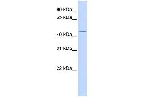 Western Blot showing HSFY1 antibody used at a concentration of 1-2 ug/ml to detect its target protein. (HSFY1 Antikörper  (Middle Region))
