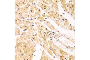 Immunohistochemistry of paraffin-embedded mouse heart using PSMD2 antibody (ABIN1874389) at dilution of 1:100 (40x lens). (PSMD2 Antikörper)