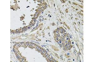 Immunohistochemistry of paraffin-embedded Human prostate using KCNK9 Polyclonal Antibody at dilution of 1:100 (40x lens). (KCNK9 Antikörper)