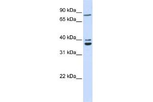 WB Suggested Anti-C18orf10 Antibody Titration: 0. (TPGS2 Antikörper  (Middle Region))