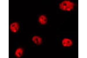 ABIN6266737 staining Hela by IF/ICC. (Histone H1 Antikörper  (Internal Region))