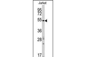 Western blot analysis of anti-RAI15 Antibody (C-term) ( (ABIN390172 and ABIN2840666) in Jurkat cell line lysates (35 μg/lane). (SMYD5 Antikörper  (C-Term))