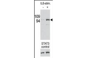 Image no. 1 for anti-Signal Transducer and Activator of Transcription 3 (Acute-Phase Response Factor) (STAT3) (pSer727) antibody (ABIN357083) (STAT3 Antikörper  (pSer727))