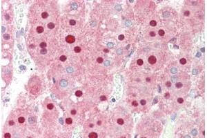 Human Adrenal: Formalin-Fixed, Paraffin-Embedded (FFPE)