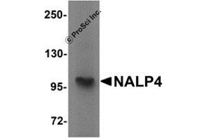 Western Blotting (WB) image for anti-NLR Family, Pyrin Domain Containing 4 (NLRP4) (Middle Region) antibody (ABIN1031008) (NLRP4 Antikörper  (Middle Region))