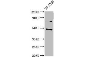 Western Blot Positive WB detected in: SH-SY5Y whole cell lysate All lanes: CSNK1E antibody at 3 μg/mL Secondary Goat polyclonal to rabbit IgG at 1/50000 dilution Predicted band size: 48 kDa Observed band size: 48 kDa (CK1 epsilon Antikörper  (Isoform epsilon))