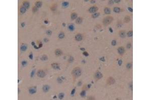 Used in DAB staining on fromalin fixed paraffin- embedded Kidney tissue (FAM19A3 Antikörper  (AA 30-129))