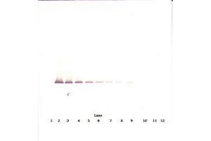 Image no. 2 for anti-Insulin-Like Growth Factor Binding Protein 7 (IGFBP7) antibody (ABIN1498817)
