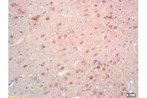 Formalin-fixed and paraffin embedded rat brain labeled with Rabbit Anti SAMD14 Polyclonal Antibody, Unconjugated (ABIN718346) at 1:200 followed by conjugation to the secondary antibody and DAB staining