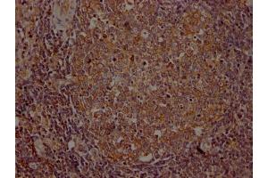IHC image of ABIN7127585 diluted at 1:100 and staining in paraffin-embedded human lymph node tissue performed on a Leica BondTM system. (Rekombinanter ITK Antikörper)
