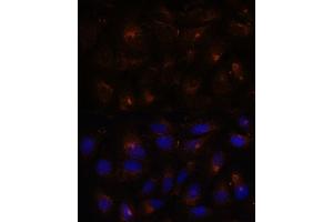 Immunofluorescence analysis of U-2 OS cells using ESYT1 antibody (ABIN7267069) at dilution of 1:100. (ESYT1 Antikörper  (AA 90-220))