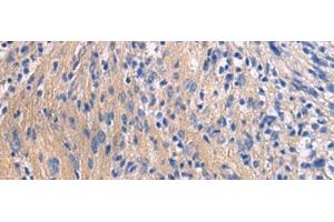 Immunohistochemistry of paraffin-embedded Human brain tissue using GALR3 Polyclonal Antibody at dilution of 1:50(x200) (GALR3 Antikörper)