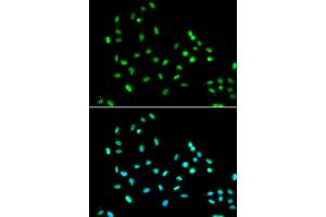 Immunofluorescence analysis of A549 cell using SMARCAD1 antibody. (SMARCAD1 Antikörper)