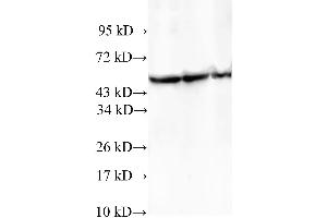 Western Blotting (WB) image for anti-T-Complex 1 (TCP1) antibody (ABIN5959099) (TCP1 alpha/CCTA Antikörper)