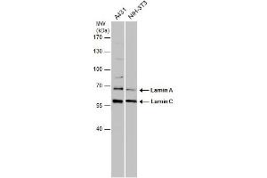 WB Image Various whole cell extracts (30 μg) were separated by 7. (Lamin A/C Antikörper)