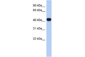 WB Suggested Anti-RASGEF1C Antibody Titration: 0. (RASGEF1C Antikörper  (N-Term))