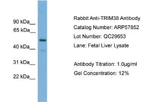 WB Suggested Anti-TRIM38  Antibody Titration: 0. (TRIM38 Antikörper  (Middle Region))