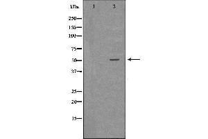 Western blot analysis of Hepg2 whole cell lysates, using CTSA Antibody. (CTSA Antikörper  (C-Term))
