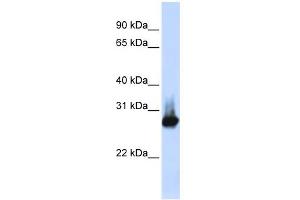 WB Suggested Anti-BCAP31 Antibody Titration:  0. (BCAP31 Antikörper  (Middle Region))