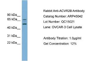 Western Blotting (WB) image for anti-Activin A Receptor, Type IIB (ACVR2B) (Middle Region) antibody (ABIN2782111)