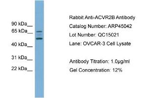 WB Suggested Anti-ACVR2B  Antibody Titration: 0. (ACVR2B Antikörper  (Middle Region))