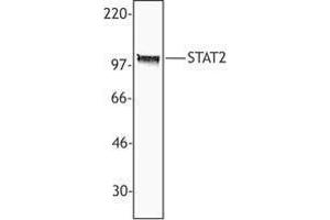 Western Blotting (WB) image for anti-Signal Transducer and Activator of Transcription 2, 113kDa (STAT2) antibody (ABIN2665501) (STAT2 Antikörper)