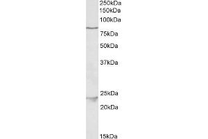 ABIN1590112 (1µg/ml) staining of HeLa lysate (35µg protein in RIPA buffer). (TBK1 Antikörper  (AA 514-527))