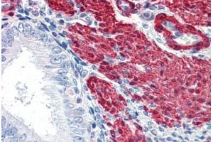 Human Uterus (formalin-fixed, paraffin-embedded) stained with TAGLN antibody ABIN337285 at 5 ug/ml followed by biotinylated anti-goat IgG secondary antibody ABIN481715, alkaline phosphatase-streptavidin and chromogen. (Transgelin Antikörper  (AA 190-201))