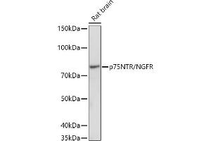 Western blot analysis of extracts of Rat brain, using (ABIN6127593, ABIN6144613, ABIN6144615 and ABIN6215090) at 1:1000 dilution. (NGFR Antikörper  (AA 273-427))