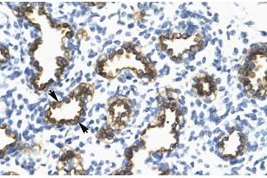 Human Lung; RFP2 antibody - middle region in Human Lung cells using Immunohistochemistry (TRIM13 Antikörper  (Middle Region))