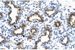 Human Lung; RFP2 antibody - middle region in Human Lung cells using Immunohistochemistry (TRIM13 Antikörper  (Middle Region))
