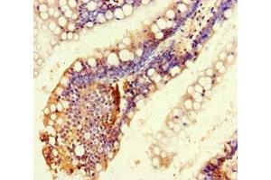 Immunohistochemistry of paraffin-embedded human small intestine tissue using ABIN7167648 at dilution of 1:100 (RTEL1 Antikörper  (AA 975-1219))