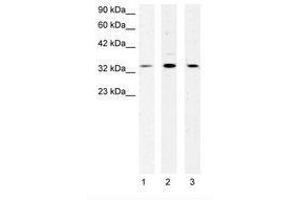 Image no. 1 for anti-Cold Shock Domain Protein A (CSDA) (AA 50-99) antibody (ABIN202366) (CSDA Antikörper  (AA 50-99))