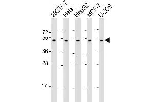 All lanes : Anti-PLAGL1 Antibody (N-Term) at 1:2000 dilution Lane 1: 293T/17 whole cell lysate Lane 2: Hela whole cell lysate Lane 3: HepG2 whole cell lysate Lane 4: MCF-7 whole cell lysate Lane 5: U-2OS whole cell lysate Lysates/proteins at 20 μg per lane. (PLAGL1 Antikörper  (AA 112-146))