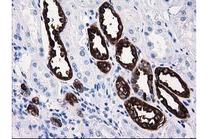 Immunohistochemical staining of paraffin-embedded Human Kidney tissue using anti-ATP6V1B1 mouse monoclonal antibody. (ATP6V1B1 Antikörper)