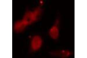 ABIN6273522 staining HeLa cells by IF/ICC. (PMS2 Antikörper  (C-Term))