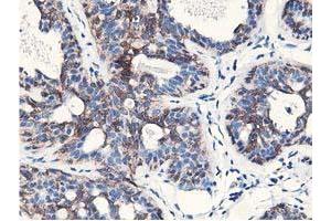 Immunohistochemical staining of paraffin-embedded Human breast tissue using anti-NUDT18 mouse monoclonal antibody. (NUDT18 Antikörper)